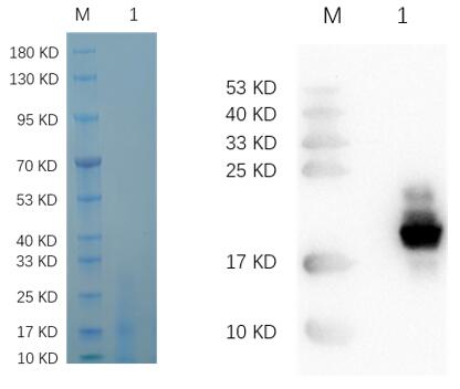 Reducing 12% SDS-PAGE and WB analysis profile